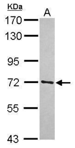 Invitrogen TRIM41 Polyclonal Antibody 100 &mu;L; Unconjugated:Antibodies,