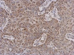 Invitrogen TTLL12 Polyclonal Antibody 100 μL; Unconjugated:Antibodies,
