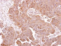 Invitrogen METTL13 Polyclonal Antibody 100 &mu;L; Unconjugated:Antibodies,
