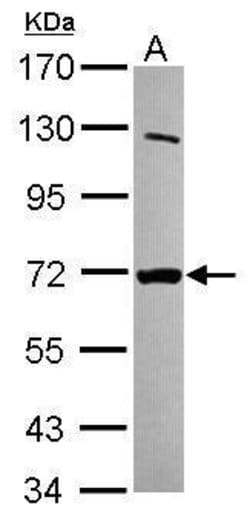 Invitrogen MTMR8 Polyclonal Antibody 100 &mu;L; Unconjugated:Antibodies,