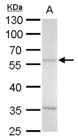Invitrogen ADC Polyclonal Antibody 100 &mu;L; Unconjugated:Antibodies,