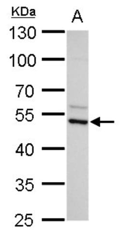 Invitrogen ADC Polyclonal Antibody 100 &mu;L; Unconjugated:Antibodies,