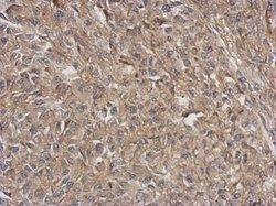 Invitrogen ARPC5L Polyclonal Antibody 100 &mu;L; Unconjugated:Antibodies,