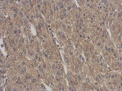 Invitrogen ARPC5L Polyclonal Antibody 100 &mu;L; Unconjugated:Antibodies,