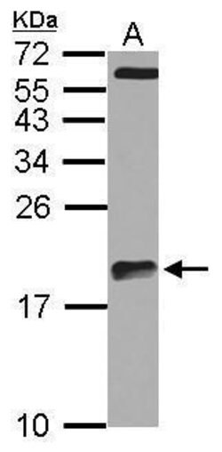 Invitrogen ARPC5L Polyclonal Antibody 100 &mu;L; Unconjugated:Antibodies,