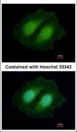 Invitrogen CBWD1 Polyclonal Antibody 100 &mu;L; Unconjugated:Antibodies,
