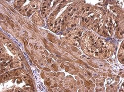 Invitrogen CBWD1 Polyclonal Antibody 100 &mu;L; Unconjugated:Antibodies,