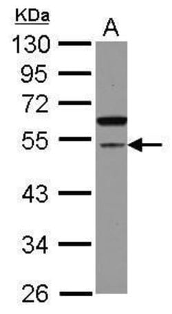 Invitrogen CDCA7L Polyclonal Antibody 100 &mu;L; Unconjugated:Antibodies,