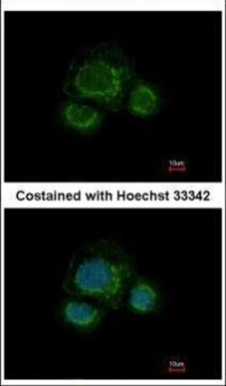 Invitrogen CHST7 Polyclonal Antibody 100 &mu;L; Unconjugated:Antibodies,