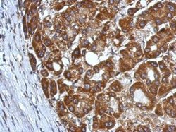 Invitrogen CHST7 Polyclonal Antibody 100 &mu;L; Unconjugated:Antibodies,