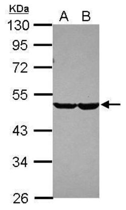 Invitrogen CHST7 Polyclonal Antibody 100 &mu;L; Unconjugated:Antibodies,