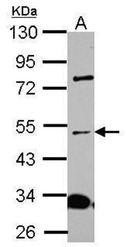 Invitrogen ICA1L Polyclonal Antibody 100 &mu;L | Buy Online | Invitrogen&trade; | Fisher Scientific