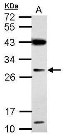 Invitrogen IMP4 Polyclonal Antibody 100 &mu;L; Unconjugated:Antikroppar