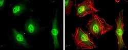 Invitrogen KIF23 Polyclonal Antibody 100 &mu;L; Unconjugated:Antibodies,
