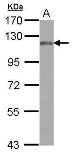 Invitrogen MAN2B2 Polyclonal Antibody 100 &mu;L; Unconjugated:Antibodies,