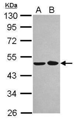 Invitrogen NOB1 Polyclonal Antibody 100 &mu;L; Unconjugated:Antibodies,