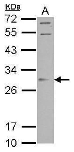 Invitrogen ORAI2 Polyclonal Antibody 100 &mu;L | Buy Online | Invitrogen&trade; | Fisher Scientific