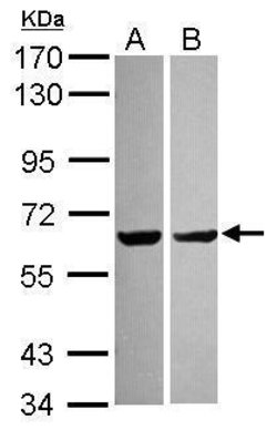 Invitrogen PYROXD2 Polyclonal Antibody 100 &mu;L | Buy Online | Invitrogen&trade; | Fisher Scientific