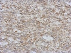 Invitrogen RAB11FIP5 Polyclonal Antibody 100 &mu;L; Unconjugated:Antibodies,