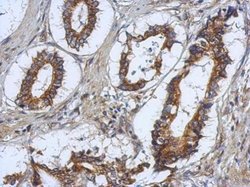 Invitrogen RASAL2 Polyclonal Antibody 100 &mu;L; Unconjugated:Antibodies,