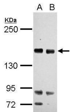 Invitrogen RASAL2 Polyclonal Antibody 100 &mu;L; Unconjugated:Antibodies,