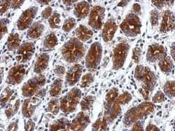 Invitrogen RILPL2 Polyclonal Antibody 100 &mu;L | Buy Online | Invitrogen&trade; | Fisher Scientific