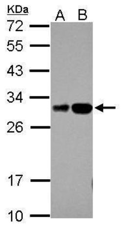 Invitrogen RILPL2 Polyclonal Antibody 100 &mu;L | Buy Online | Invitrogen&trade; | Fisher Scientific