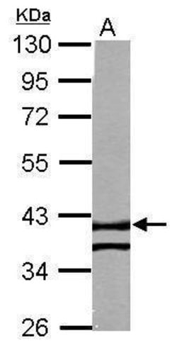 Invitrogen RTN4IP1 Polyclonal Antibody 100 &mu;L; Unconjugated:Antibodies,