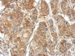 Invitrogen TSR2 Polyclonal Antibody 100 &mu;L; Unconjugated:Antibodies,