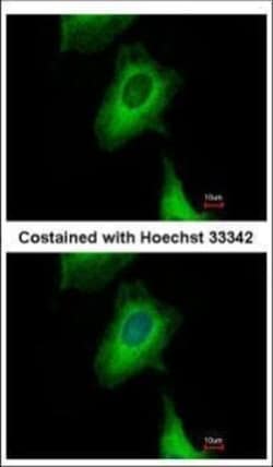 Invitrogen UBXN1 Polyclonal Antibody 100 &mu;L; Unconjugated:Antibodies,
