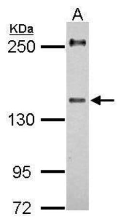 Invitrogen URB2 Polyclonal Antibody 100 &mu;L; Unconjugated:Antibodies,