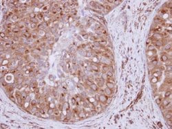 Invitrogen XPO6 Polyclonal Antibody 100 μL; Unconjugated:Antibodies,