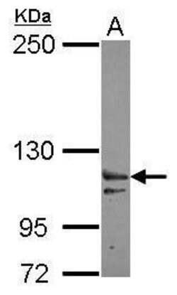 Invitrogen XPO6 Polyclonal Antibody 100 μL; Unconjugated:Antibodies,