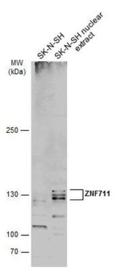 Invitrogen ZNF711 Polyclonal Antibody 100 &mu;L; Unconjugated:Antibodies,