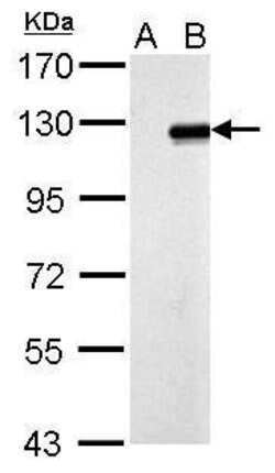 Invitrogen ZNF711 Polyclonal Antibody 100 &mu;L; Unconjugated:Antibodies,