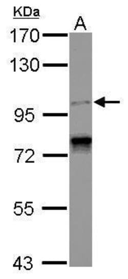 Invitrogen SPICE1 Polyclonal Antibody 100 &mu;L | Buy Online | Invitrogen&trade; | Fisher Scientific
