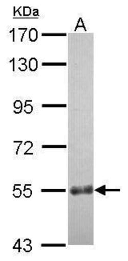 Invitrogen CCDC7 Polyclonal Antibody 100 &mu;L; Unconjugated:Antikroppar