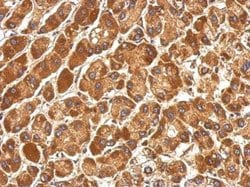 Invitrogen COG3 Polyclonal Antibody 100 &mu;L; Unconjugated:Antibodies,