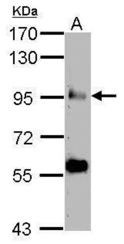 Invitrogen COG3 Polyclonal Antibody 100 &mu;L; Unconjugated:Antibodies,