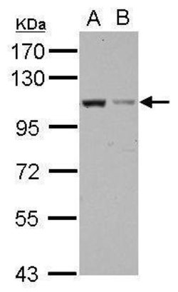 Invitrogen EXOC2 Polyclonal Antibody 100 &mu;L; Unconjugated:Antibodies,