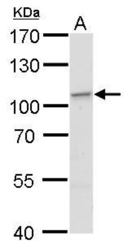 Invitrogen EXOC2 Polyclonal Antibody 100 &mu;L; Unconjugated:Antibodies,