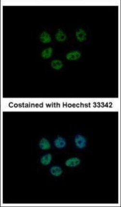 Invitrogen KDM6A Polyclonal Antibody 100 &mu;L | Buy Online | Invitrogen&trade; | Fisher Scientific