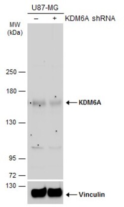 Invitrogen KDM6A Polyclonal Antibody 100 &mu;L | Buy Online | Invitrogen&trade; | Fisher Scientific