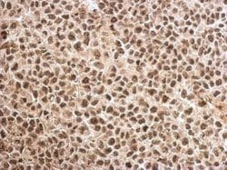 Invitrogen MAGEB18 Polyclonal Antibody 100 &mu;L; Unconjugated:Antibodies,