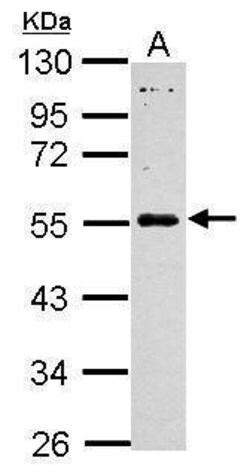 Invitrogen MAGEB18 Polyclonal Antibody 100 &mu;L; Unconjugated:Antibodies,