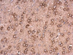 Invitrogen NCALD Polyclonal Antibody 100 &mu;L; Unconjugated:Antibodies,