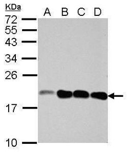 Invitrogen NCALD Polyclonal Antibody 100 &mu;L; Unconjugated:Antibodies,