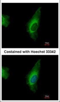 Invitrogen ORP8 Polyclonal Antibody 100 &mu;L; Unconjugated:Antibodies,