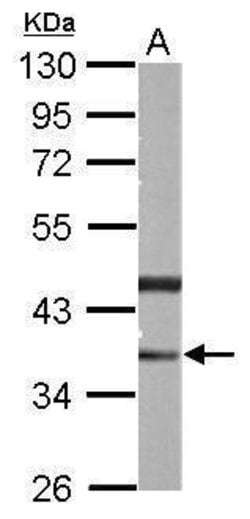 Invitrogen PHYHIP Polyclonal Antibody 100 &mu;L; Unconjugated:Antibodies,