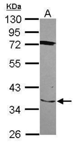 SLC25A28 Polyclonal Antibody, Invitrogen 100 &mu;L; Unconjugated:Antibodies,